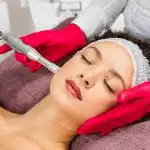 Formation microneedling à Marseille