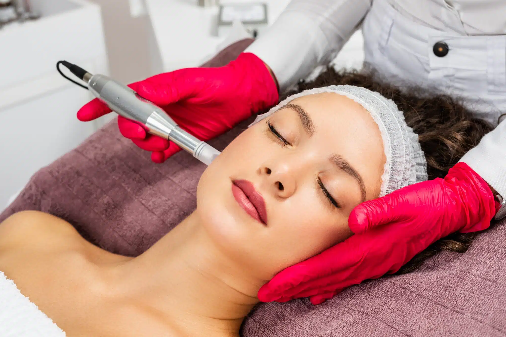 Formation microneedling à Marseille
